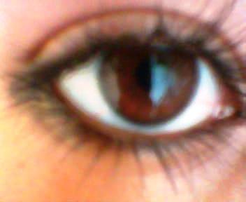 my eye